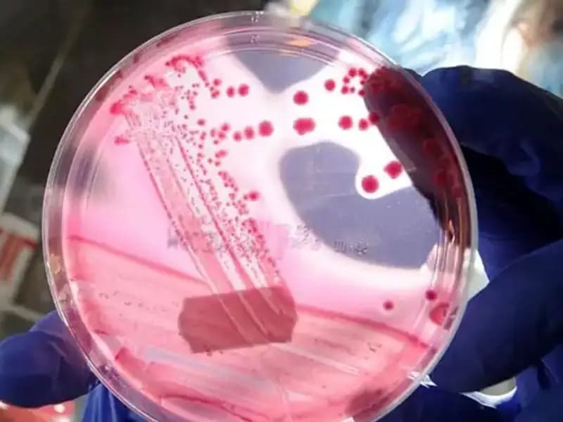 Bilim İnsanları, AP2A1 Proteini ile Yaşlanmayı Geri Almanın Yolunu Buldu!