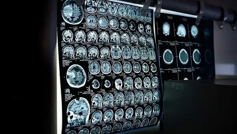 İstanbul’da 81 Bini Aşan Kişiye Ücretsiz Kanser Taraması Hizmeti Sunuldu