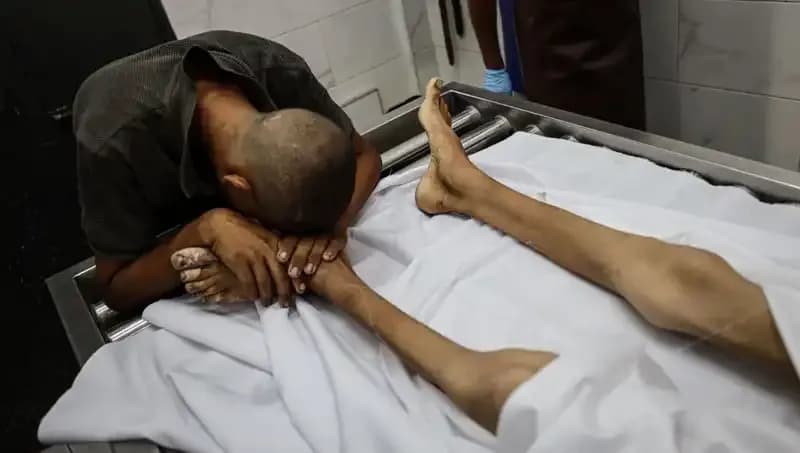 Gazze'de Açlık Problemi: Bir Çocuğun Daha Hayatı Son Buldu