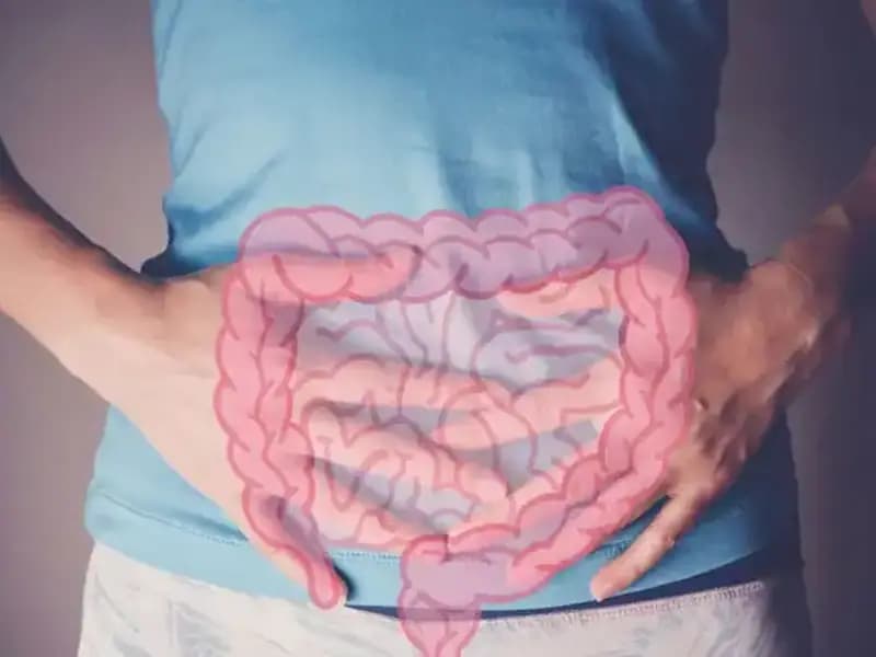 Gençlerde İleri Evre Kolon Kanseri Artışı: Uzmanlardan Çarpıcı Uyarılar