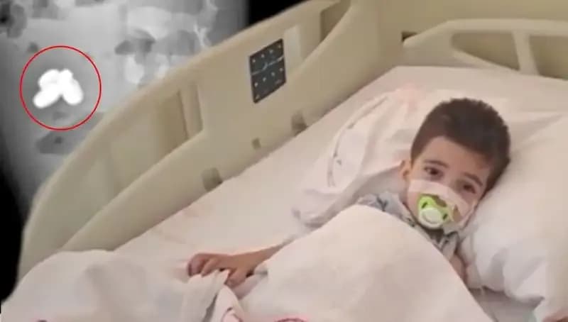 Kalp Kıran Olay: Pil ve Mıknatıs Yutan Çocuğun Bağırsakları Yanıyor