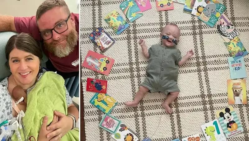 Dünyanın En Prematüre Bebeği: 280 Gramla Hayata Merhaba Dedi!