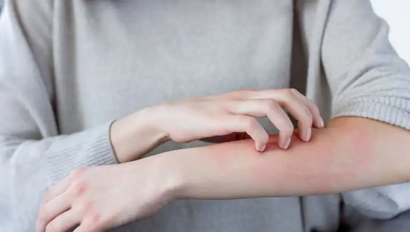 Cilt Kanseri Belirtilerini Kaçırmayın: Dermatologdan İpuçları