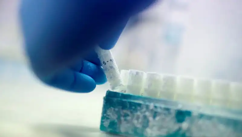 85 Sperm Donörü: Tıbbi Felaket ile Binlerce Çocuğun Baba Olma Hikayesi